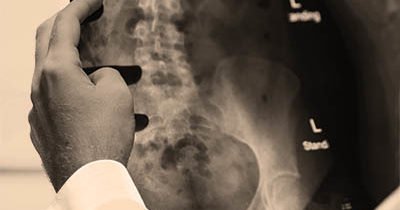 The Best Chiropractors in San Francisco are here for you