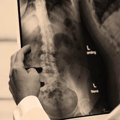 The Best Chiropractors in San Francisco are here for you